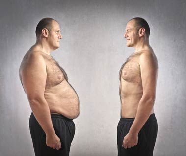 Obese man before and after medical weight loss intervention