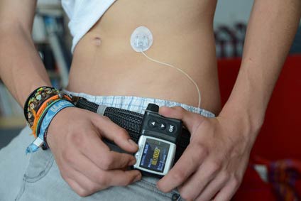 Young person with insulin pump worn around waist